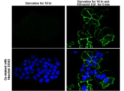 Invitrogen Phospho-EGFR (Tyr1148) Polyclonal Antibody 100 &mu;L | Buy Online | Invitrogen&trade; | Fisher Scientific