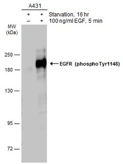 Invitrogen Phospho-EGFR (Tyr1148) Polyclonal Antibody 100 &mu;L | Buy Online | Invitrogen&trade; | Fisher Scientific