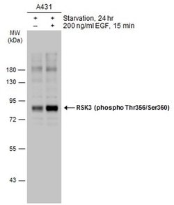 Invitrogen Phospho-RSK3 (Thr356, Ser360) Polyclonal Antibody 100 &mu;L;