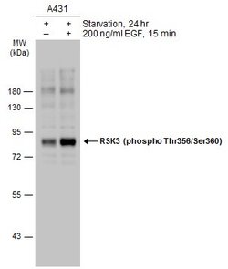 Invitrogen Phospho-RSK3 (Thr356, Ser360) Polyclonal Antibody 100 &mu;L;