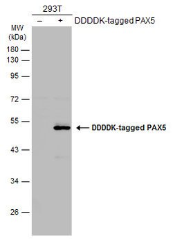 Invitrogen PAX5 Polyclonal Antibody 100 &mu;L | Buy Online | Invitrogen&trade; | Fisher Scientific
