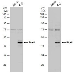 Invitrogen PAX5 Polyclonal Antibody 100 &mu;L | Buy Online | Invitrogen&trade; | Fisher Scientific