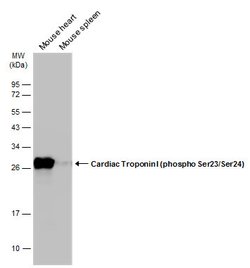 Invitrogen Phospho-Cardiac Troponin I (Ser23, Ser24) Polyclonal Antibody