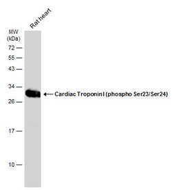 Invitrogen Phospho-Cardiac Troponin I (Ser23, Ser24) Polyclonal Antibody