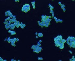 Invitrogen CD4 Polyclonal Antibody 100 &mu;L; Unconjugated:Antibodies,