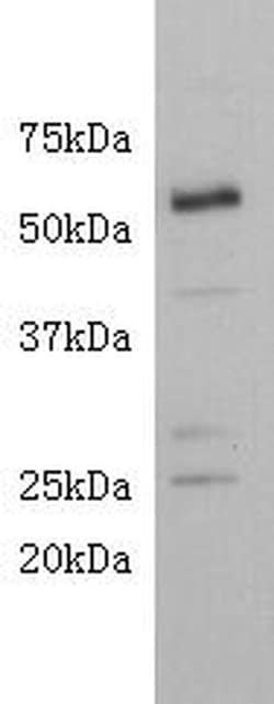 Invitrogen CD4 Polyclonal Antibody 100 &mu;L; Unconjugated:Antibodies,