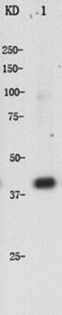 Invitrogen alpha-Cardiac Actin Polyclonal Antibody 100 &mu;L; Unconjugated:Antibodies,