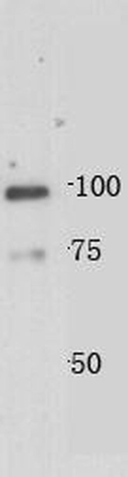 Invitrogen JPH2 Polyclonal Antibody 100 &mu;L; Unconjugated:Antibodies,