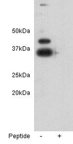 Invitrogen Rex1 Polyclonal Antibody 100 &mu;L; Unconjugated:Antibodies,