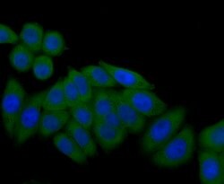Invitrogen TIE1 Polyclonal Antibody 100 &mu;L; Unconjugated:Antibodies,
