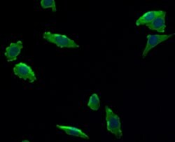 Invitrogen TIE1 Polyclonal Antibody 100 &mu;L; Unconjugated:Antibodies,