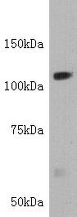 Invitrogen TIE1 Polyclonal Antibody 100 &mu;L; Unconjugated:Antibodies,