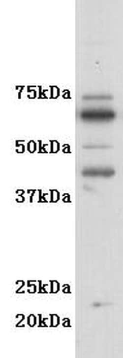 Invitrogen CD116 Polyclonal Antibody 100 &mu;L; Unconjugated:Antibodies,