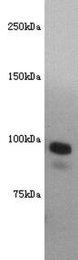 Invitrogen CD10 Polyclonal Antibody 100 &mu;L; Unconjugated:Antibodies,
