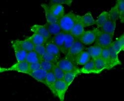Invitrogen CD171 (L1CAM) Polyclonal Antibody 100 &mu;L; Unconjugated:Antibodies,