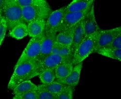 Invitrogen CD171 (L1CAM) Polyclonal Antibody 100 &mu;L; Unconjugated:Antibodies,