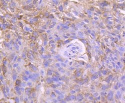Invitrogen CD171 (L1CAM) Polyclonal Antibody 100 &mu;L; Unconjugated:Antibodies,