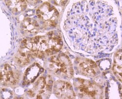 Invitrogen CD171 (L1CAM) Polyclonal Antibody 100 &mu;L; Unconjugated:Antibodies,