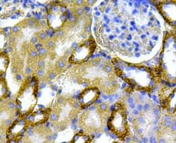Invitrogen CD171 (L1CAM) Polyclonal Antibody 100 &mu;L; Unconjugated:Antibodies,