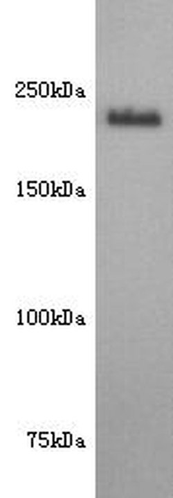Invitrogen CD171 (L1CAM) Polyclonal Antibody 100 &mu;L; Unconjugated:Antibodies,