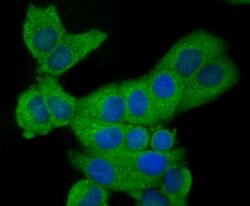 Invitrogen CD62E (E-selectin) Polyclonal Antibody 100 &mu;L; Unconjugated:Antibodies,