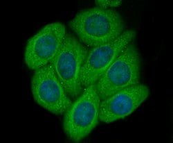 Invitrogen CD62E (E-selectin) Polyclonal Antibody 100 &mu;L; Unconjugated:Antibodies,
