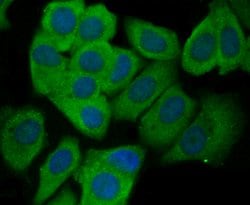 Invitrogen CD62E (E-selectin) Polyclonal Antibody 100 &mu;L; Unconjugated:Antibodies,