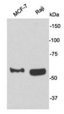 Invitrogen CD62E (E-selectin) Polyclonal Antibody 100 &mu;L; Unconjugated:Antibodies,