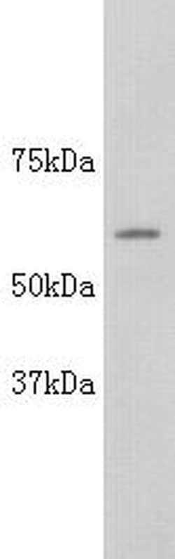 Invitrogen Alkaline Phosphatase (Isoform 4) Polyclonal Antibody 100 &mu;L;