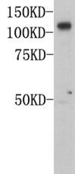 Invitrogen CD146 Polyclonal Antibody 100 &mu;L; Unconjugated:Antibodies,