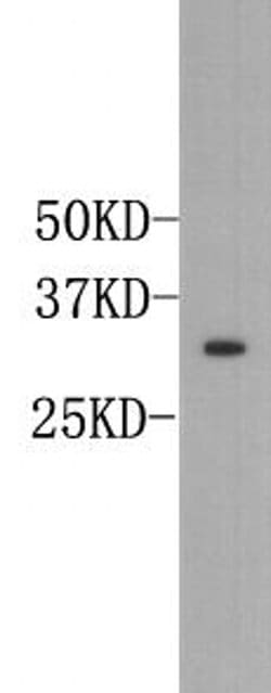 Invitrogen Osteopontin Polyclonal Antibody 100 &mu;L; Unconjugated:Antibodies,