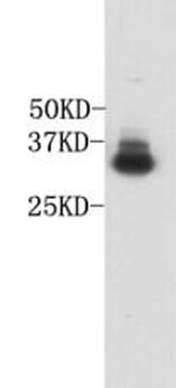 Invitrogen CD235a (Glycophorin A) Polyclonal Antibody 100 &mu;L; Unconjugated:Antibodies,