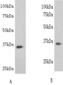 Invitrogen LDHB Polyclonal Antibody 100 &mu;L | Buy Online | Invitrogen&trade; | Fisher Scientific