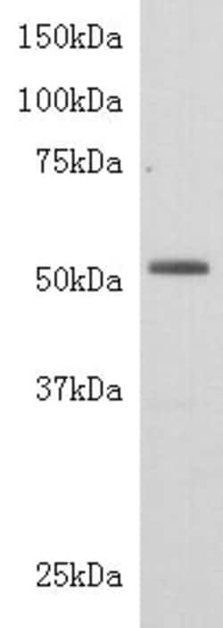 Invitrogen TDT Polyclonal Antibody 100 &mu;L | Buy Online | Invitrogen&trade; | Fisher Scientific