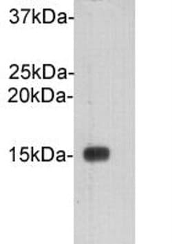 Invitrogen Cystatin C Polyclonal Antibody 100 &mu;L; Unconjugated:Antibodies,
