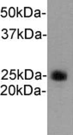 Invitrogen Ly-6G Polyclonal Antibody 100 &mu;L; Unconjugated:Antibodies,