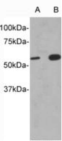 Invitrogen CD213a1 (IL-13Ra1) Polyclonal Antibody 100 &mu;L | Buy Online | Invitrogen&trade; | Fisher Scientific