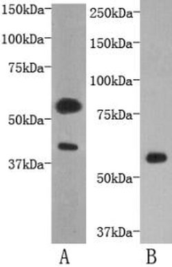 Invitrogen TMEM57 Polyclonal Antibody 100 &mu;L | Buy Online | Invitrogen&trade; | Fisher Scientific