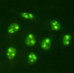 Invitrogen PGBD5 Polyclonal Antibody 100 &mu;L; Unconjugated:Antibodies,