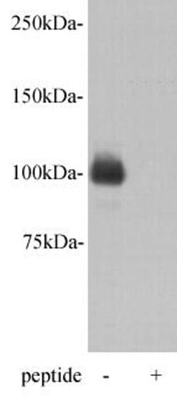 Invitrogen PGBD5 Polyclonal Antibody 100 &mu;L; Unconjugated:Antibodies,