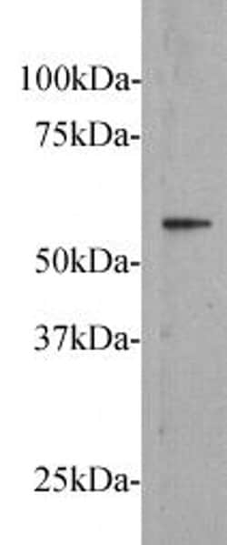 Invitrogen FZD5 Polyclonal Antibody 100 &mu;L; Unconjugated:Antibodies,