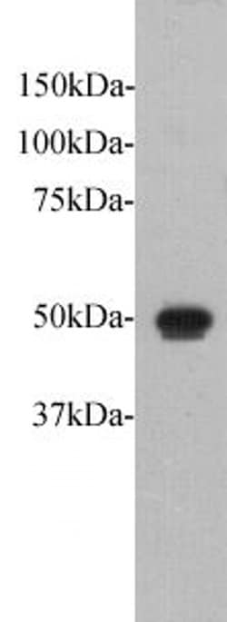 Invitrogen FAT1 Polyclonal Antibody 100 &mu;L; Unconjugated:Antibodies,