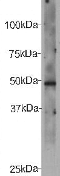 Invitrogen CELSR2 Polyclonal Antibody 100 &mu;L; Unconjugated:Antibodies,