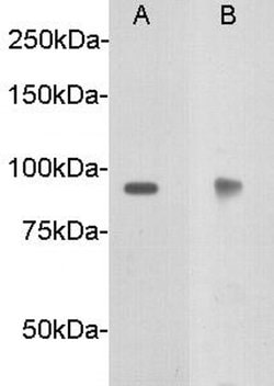 Invitrogen DCC Polyclonal Antibody 100 &mu;L; Unconjugated:Antibodies,