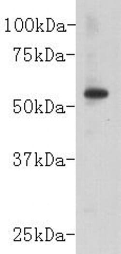 Invitrogen CD147 Polyclonal Antibody 100 &mu;L | Buy Online | Invitrogen&trade; | Fisher Scientific