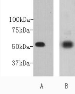 Invitrogen CD271 (NGF Receptor) Polyclonal Antibody 100 &mu;L; Unconjugated:Antibodies,