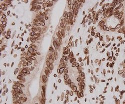 Invitrogen Lamin B2 Polyclonal Antibody 100 &mu;L; Unconjugated:Antibodies,