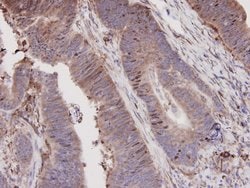 Invitrogen N-cadherin Polyclonal Antibody 100 &mu;L | Buy Online | Invitrogen&trade; | Fisher Scientific