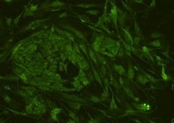 Invitrogen CD34 Polyclonal Antibody 100 &mu;L; Unconjugated:Antibodies,