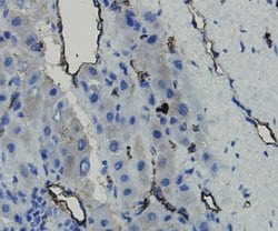 Invitrogen CD34 Polyclonal Antibody 100 &mu;L; Unconjugated:Antibodies,